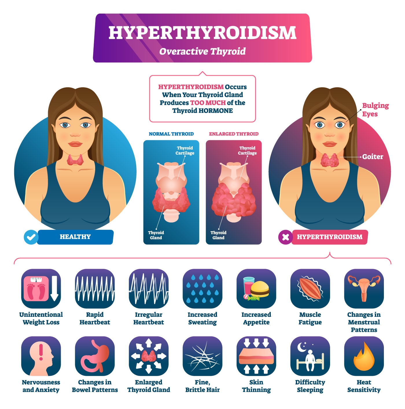 The signs and symptoms of Hyperthyroidism (overactive thyroid)