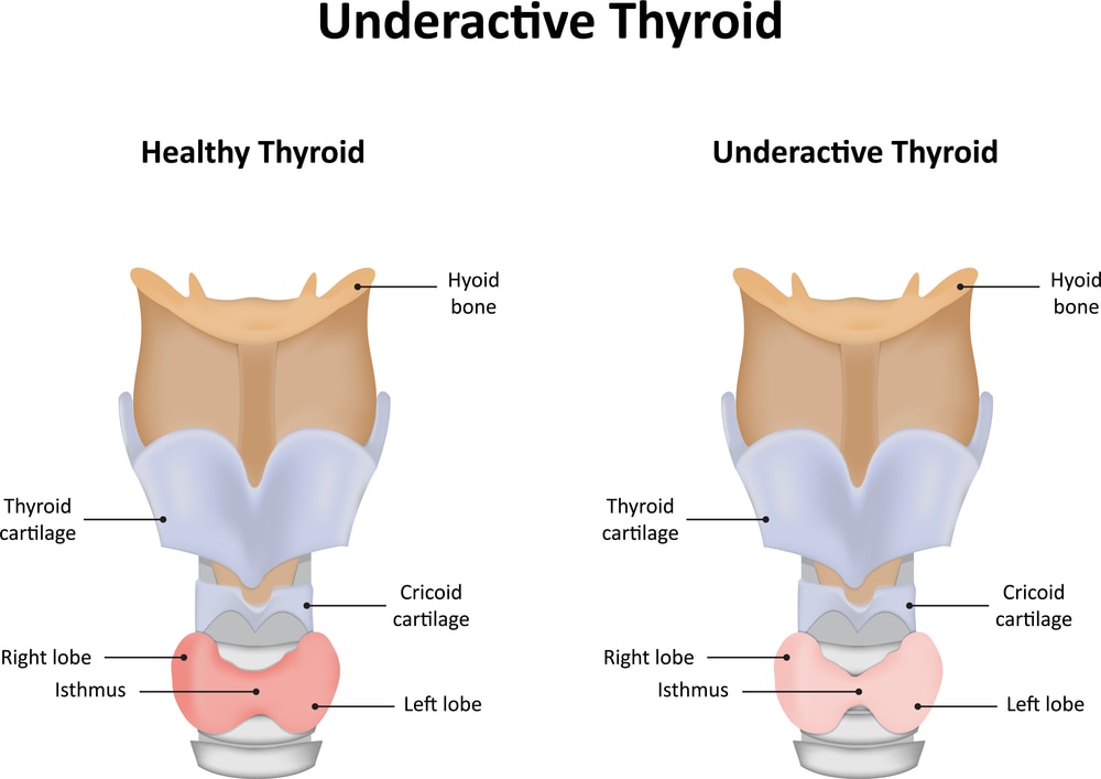 Healthy Thyroid vs Underactive Thyroid